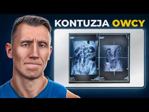 POWAŻNA KONTUZJA OWCY! *KONIEC Z MARATONAMI?*