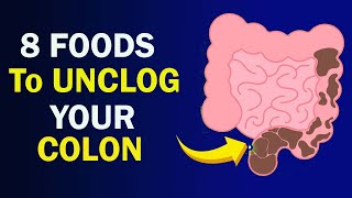 8 Amazing Foods To Unclog Your Colon FAST