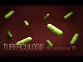 Understanding Tuberculosis and Immune Response