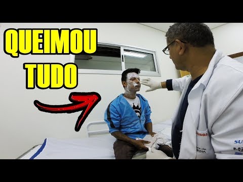 ACIDENTE NO CAÇADOR DE LENDA 😢 FUI PRO HOSPITAL