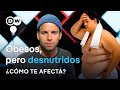 Epidemia de Obesidad en América Latina