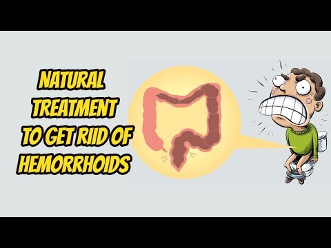 Natural Treatment for Hemorrhoids - How to Treat...