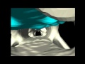 e-Dura Implantation and Effects
