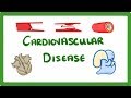 Cardiovascular Disease and Treatments
