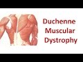Duchenne Muscular Dystrophy Overview