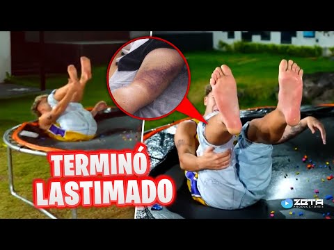 IAN LUCAS TUVO UN ACCIDENTE por GRABAR ESTE VIDEO con FEDE VIGEVANI 😨😨 * ¡Terminó en el hospital!