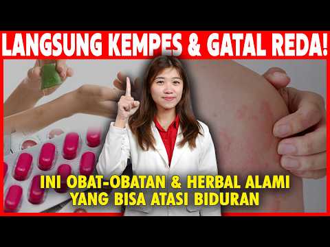 Kulit Merah Gatal-Gatal? Jangan Minum Obat! Atasi Biduran dengan Cara Alami Ini