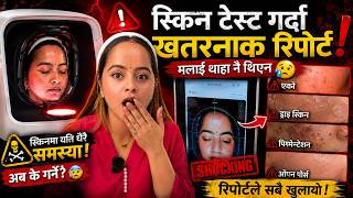 🔥 Skin Test Report Shock 😱 | मेरो अनुहारको लुकेको समस्या बाहिर आयो!