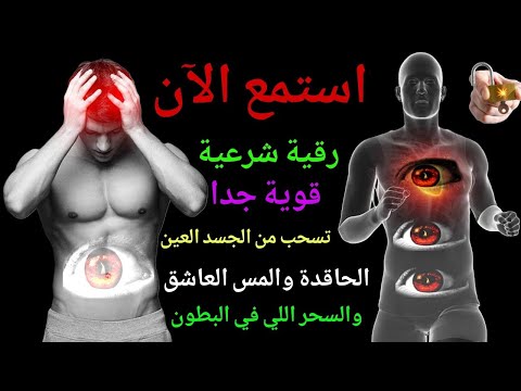 "رقية شرعية للصداع والأرق بسبب العين والحسد والسحر – من الكتاب والسنة"