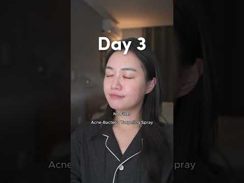 Bacteria Targeting Spray #chxrryglowy #orien #toner #acnetreatment