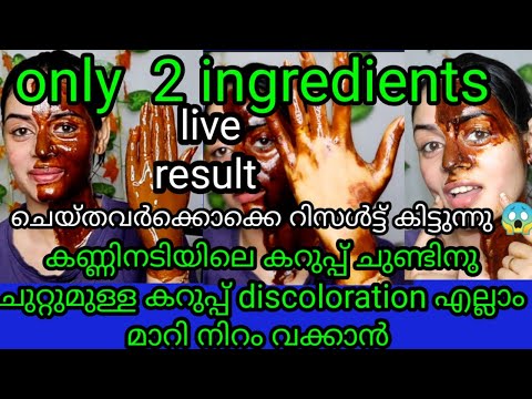 അടുക്കളയിലെ 2 ഐറ്റംസ്  മതി കണ്ണിനടിയിലെ കറുപ്പ്, കഴുത്തിലുള്ള കറുപ്പ്,എല്ലാം മാറി നിറം വക്കാൻ