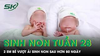 Sinh đôi ở tuần thai 28, hai bé chưa tròn 1kg vượt ải sinh non sau hơn 80 ngày | SKĐS