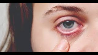 HOW TO SAFEGUARD OURSELVES FROM THE BAD EFFECTS