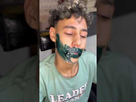 علاج شنب كرت الفكه 😱😂✂️#subscribe #تحشيش #viralyoutubeshorts #barbershop #كوميديات #hairstyle