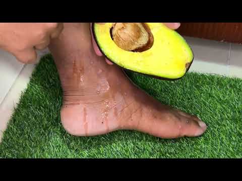 Adiós al dolor de pies y rodillas con este remedio natural que aprendí en casa