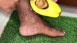 Adiós al dolor de pies y rodillas con este remedio natural que aprendí en casa