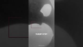 The Tilikum Tragedy #Shorts