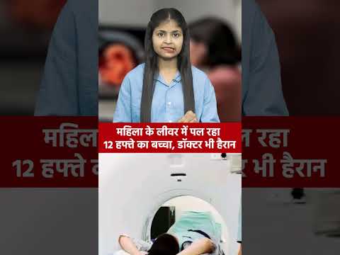 महिला के लीवर में पल रहा 12 हफ्ते का बच्चा, डॉक्टर भी हैरान