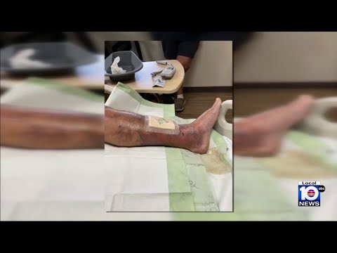 YouTube video thumbnail: Warning Comes From Experts Regarding Flesh-Eating Bacteria in Florida