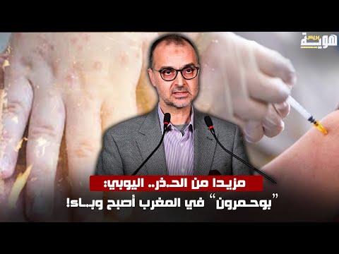 مزيدا من الحـ.ذر.. اليوبي: “بوحـمرون” في المغرب أصبح وبـ.ـاء!