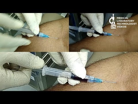 Safe and effective blood draw technique. How to take...