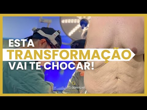 TRANSFORMAÇÃO INCRÍVEL: Cirurgia Plástica Pós-Bariátrica com LADSTRONG - RECUPERE sua AUTOESTIMA!