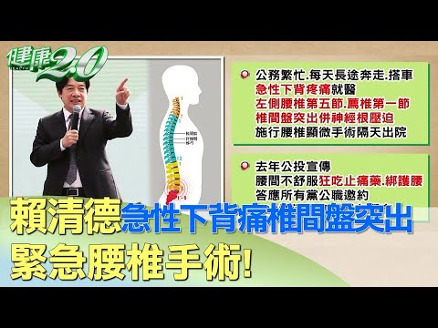 賴清德急性下背痛椎間盤突出 緊急腰椎手術！ 健康2.0