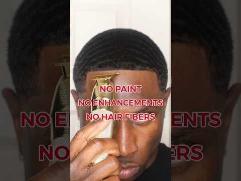 How to RESTORE your thin HAIRLINE💯🔥🔥🔥 #360silk #hairloss #hairgrowth