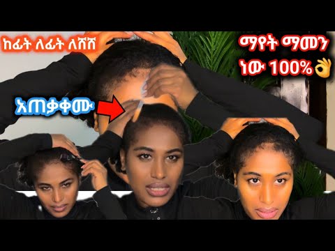 ፀጉራችሁ ከፊት ለፊት ለሸሸ፣ ለተመለጠ ፤ግንባራም፣ራስ በራ ለሆናችሁ #minoxidil