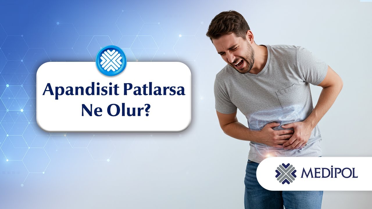 Apandisit Patlarsa Ne Olur?