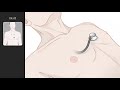 Understanding Heartbeat Sounds