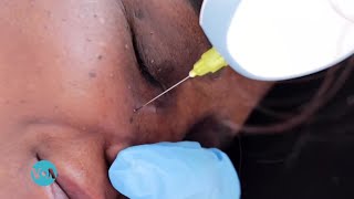 የቆዳ ላይ ቀላል እብጠት መሰል ነገሮች እና የቆዳ ቀለምን የሚለውጡ ምልክቶች ለጤና ያሳስቡ ይኾን?