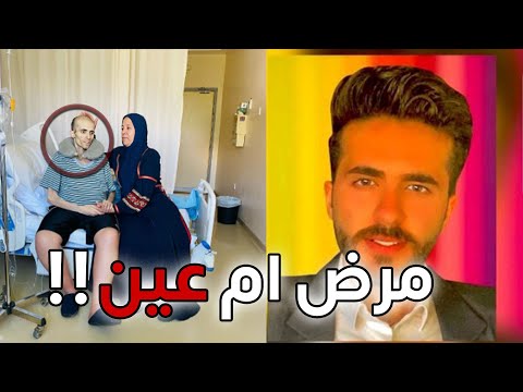 تغير شكله بالكامل ايش السبب !!