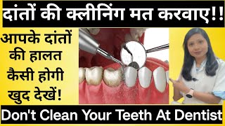 दांतों की सफाई के बाद ऐसा होगा😱 |Danto Ki Safai Karwane Ka Sach |Teeth Cleaning Good Or Bad - Truth?