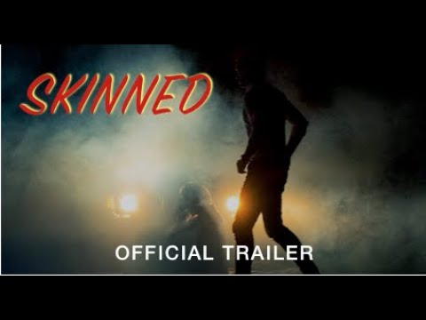 SKINNED | Official Trailer - HD