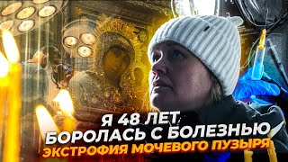 Я 48 лет боролась с болезнью / Мочевой пузырь был сформирован наружу