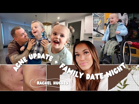 Beckham and Blakely Control Our Night + Acne and Medication Changes