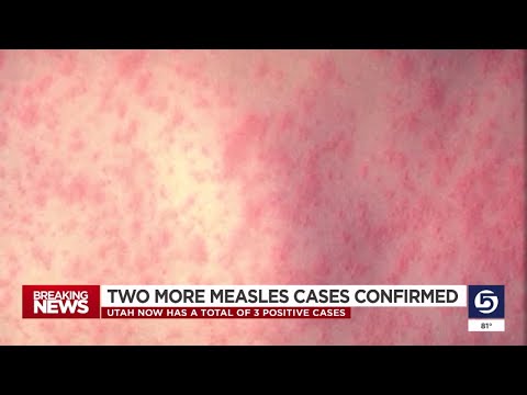 YouTube video thumbnail: 2 New Measles Cases Confirmed in Utah