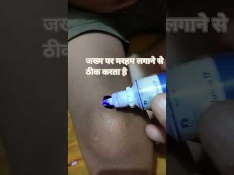 पहले जख्म को साफ करते हैं उसके बाद बीटिडीन लोशन लगाते हैं तभी ठीक होता है, डॉ ‌‌के सलाह से ही लें