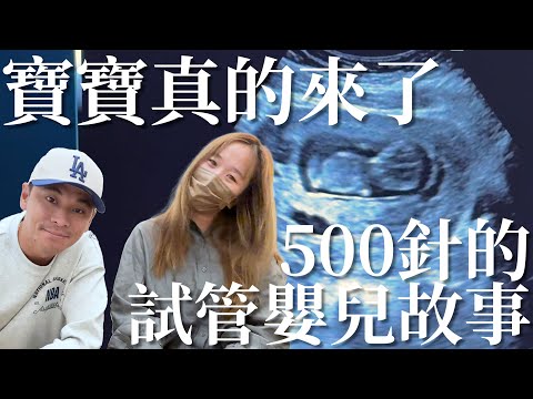 【試管嬰兒（下）】看到小孩動的一刻！淚崩了！我要當爸爸了！500針試管嬰兒故事！【豹子腿方昶詠】#送子鳥 #試管寶寶 #孩子