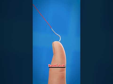 ماذا تفعل اذا علقت سنارة الصيد في يدك! 😱؟