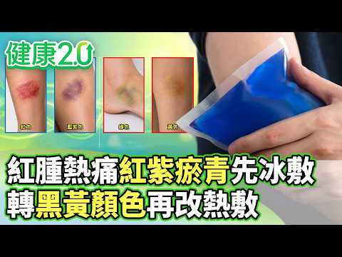 紅腫熱痛紅紫瘀青先冰敷 轉黑黃顏色再改熱敷【健康2.0分段】@tvbshealth20  EP3228-3 20260906 #陳欣湄#韋汝#江清泉#侯鐘堡#胡逸惟#鄒瑋倫#彥寬
