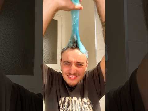😱unbelievable this boy stuck chewing gum in his hair|#shortvideo