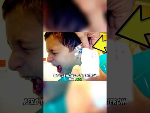 Pensó Que Tenía Un Lápiz Atascado En La Oreja, Pero Los Médicos Descubrieron Algo Mucho Peor