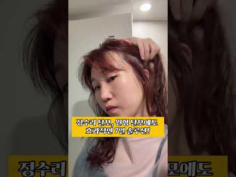 #비오티아토닉 #탄산토닉 #<strong>정수리탈모</strong> #헤어토닉추천