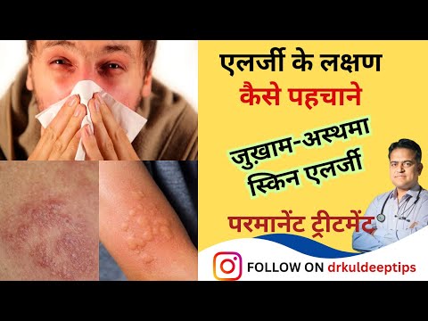 एलर्जी के प्रकार और एलर्जी के लक्षण । होम्योपैथी में परमानेंट इलाज । Symptoms of allergy ।
