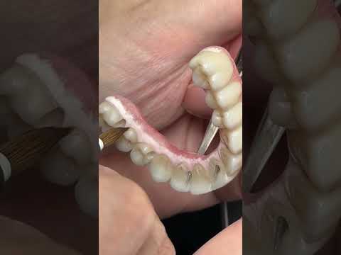 Brush technique for tissue porcelain