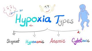Types of Hypoxia (Stagnant, Hypoxemic, Anemic & Cytotoxic) - Pathophysiology