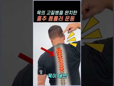 목의 고질병을 4년만에 완치한 흉추 폼롤러 운동