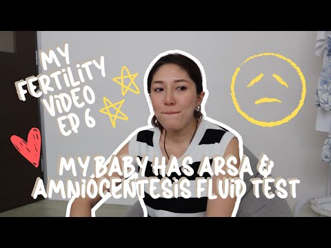 My Fertility Journey Ep 6 - My baby has ARSA & Amniocentesis Fluid Test